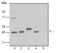 pClpP | Chloroplastic ATP-dependent Clp protease proteolytic subunit 1